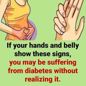 If your hands and belly show these signs, you may be suffering from diebetes without realizing it If your hands and belly show these signs, you may be suffering from diebetes without realizing it